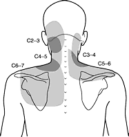 Referred Pain From Facet Joints