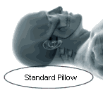 Help To Restore Normal Neck Curve